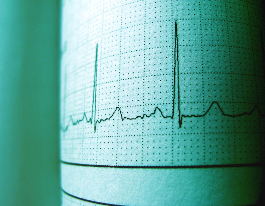 Cardio et VO2 max